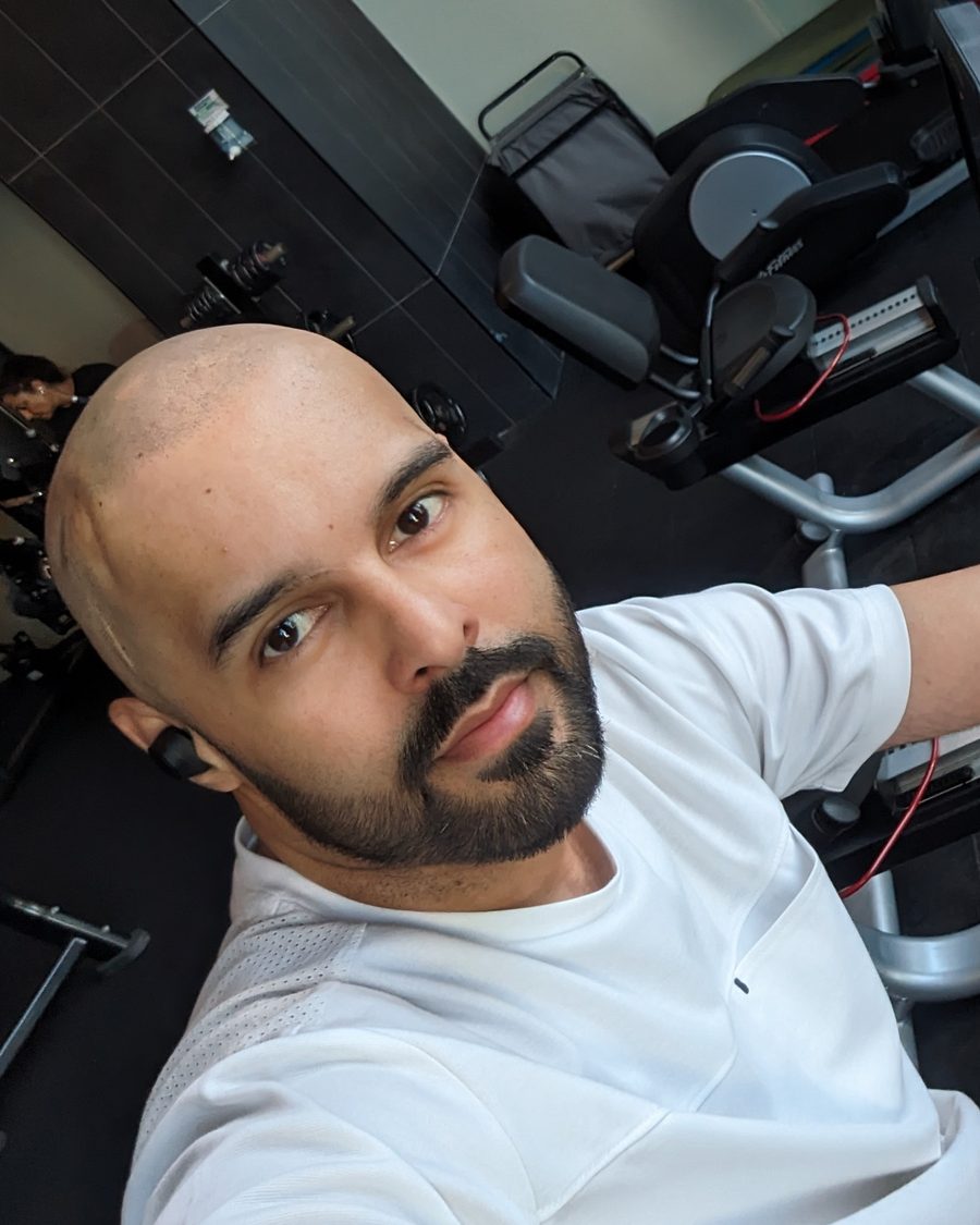 Mandeep Sandhu at the gym — surgery scar visible, mid-training